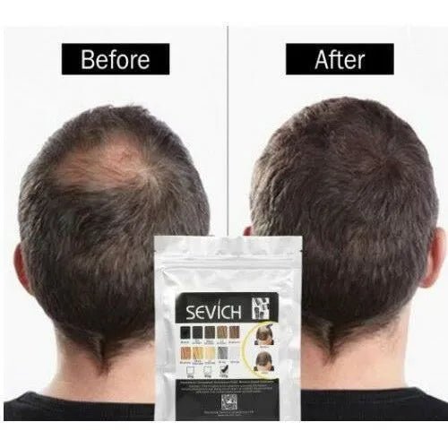 🌟 Fibres Capillaires Épaississantes – Cheveux