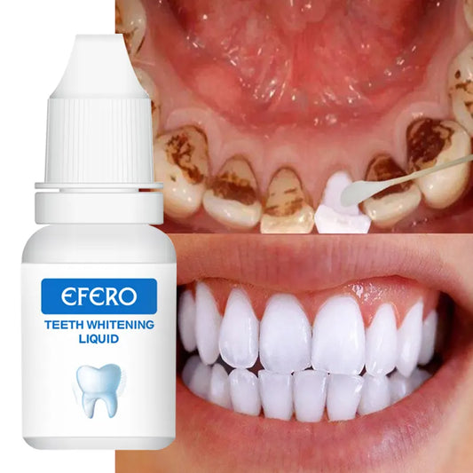 Essence de blanchiment des dents EFERO
